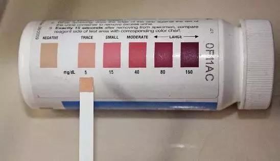 健酮,癫痫疗法,生酮,生酮饮食,生酮饮食疗法